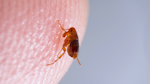 A flea on a human finger