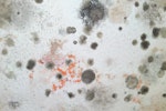 Black mould growth on walls appears as dark marks